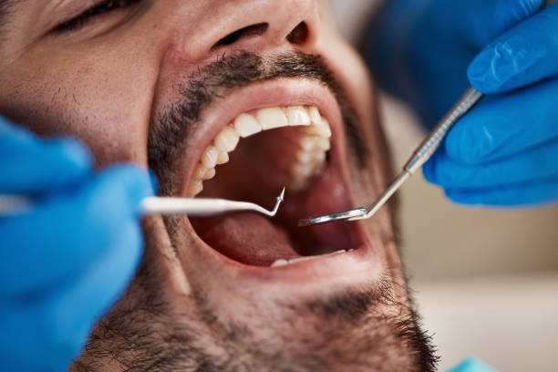 Best Emergency Root Canal Therapy in Simonton Lake, IN