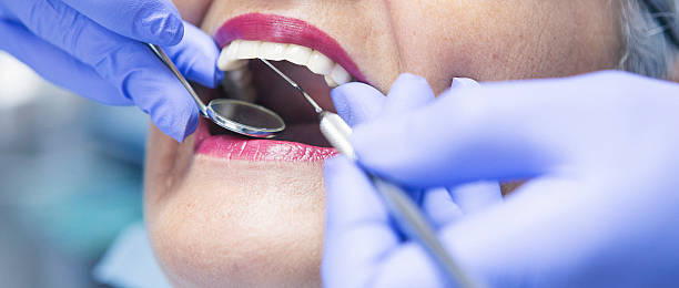 Best Knocked-Out Tooth (Avulsed Tooth) Treatment in Simonton Lake, IN
